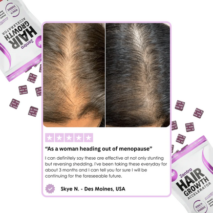 Hair Growth Accelerator Soft Chews