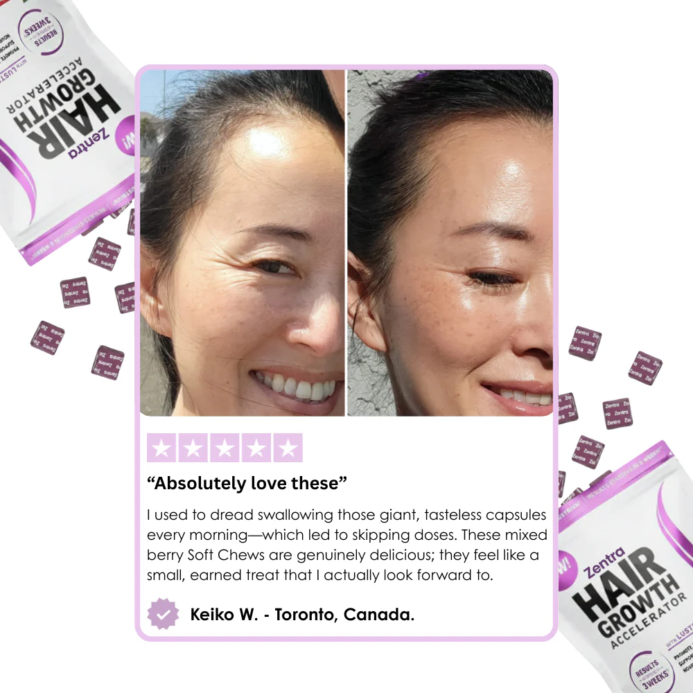 Hair Growth Accelerator Soft Chews